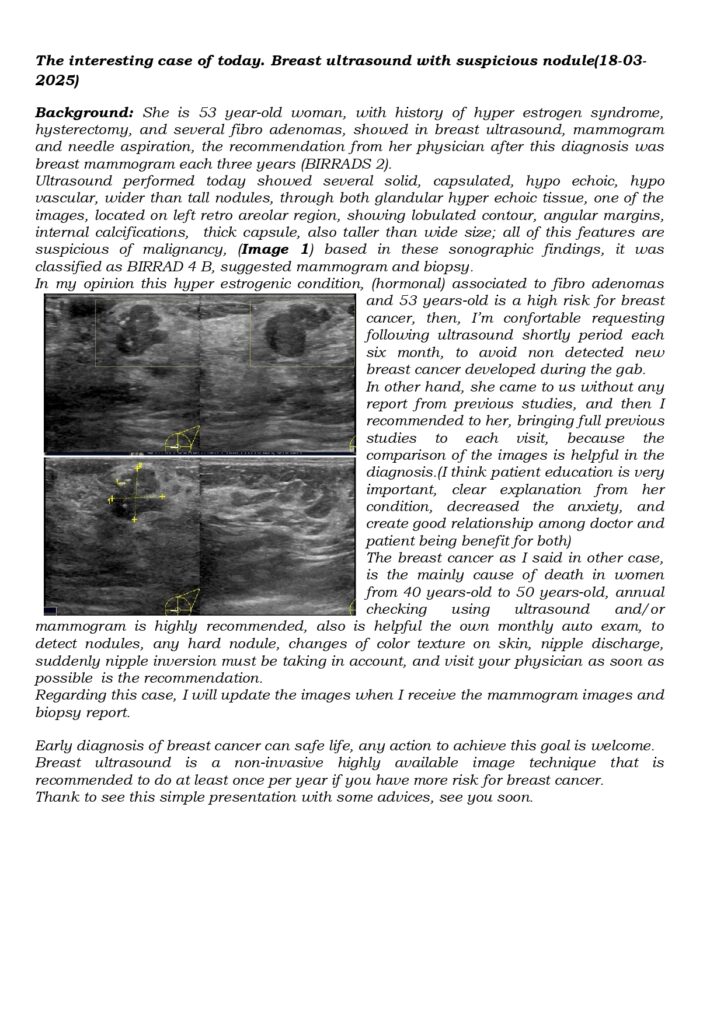 Descripcion en ingles